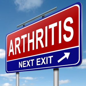 Arthritis Symptoms