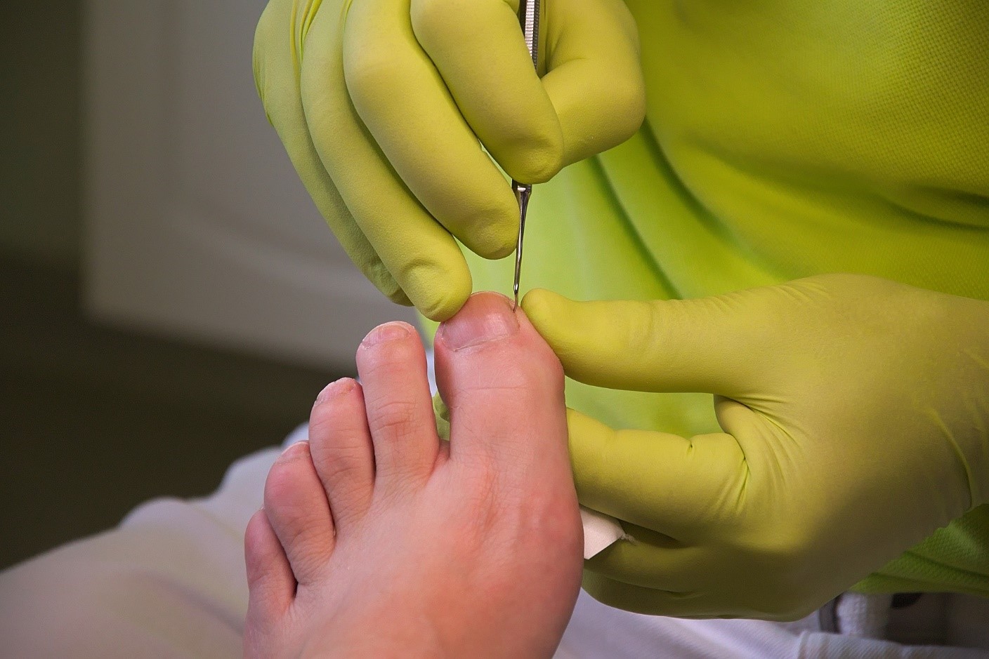 How to Prevent Diabetic Foot Ulcers